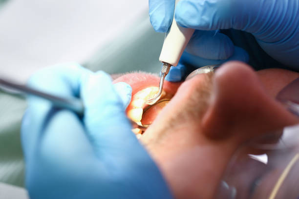 Best Weekend Emergency Dentist in Pikesville, MD