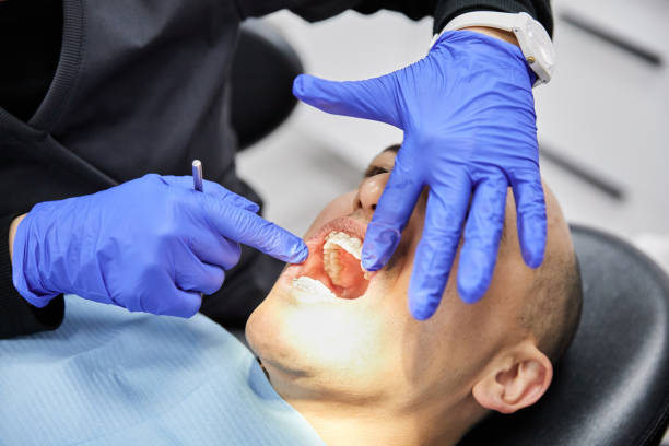 Best Emergency Wisdom Teeth Removal in Pikesville, MD