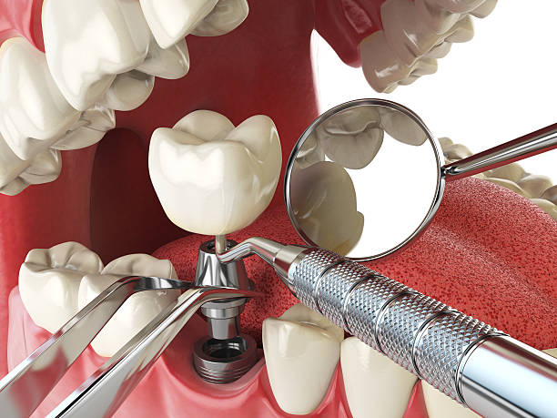 Best Same-Day Emergency Dental Services in Pikesville, MD